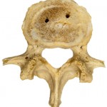 a typical lumbar vertebra