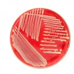 MRSA growing on a culture plate.